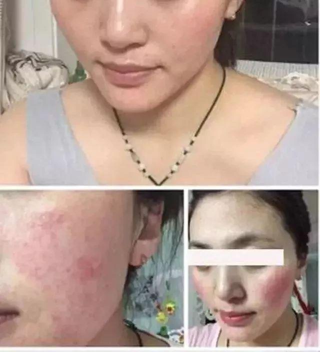 冻干粉用在护肤的哪个步骤，冻干粉免洗面膜效果怎么样（冻干粉是什么，有什么作用）