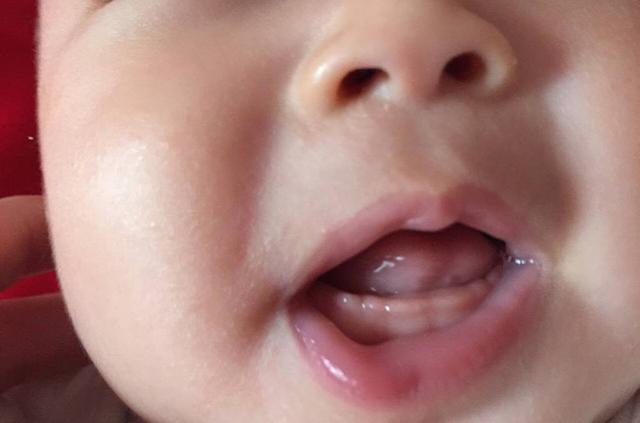 婴儿牙齿生长顺序图和时间，儿童牙齿更换顺序图（看看你家娃有没有达标）