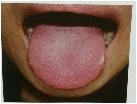 如何看舌苔图解，如何学会看舌苔（5大舌诊图谱和对策）