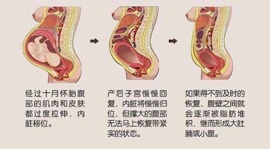 产后子宫收缩好的表现，产后子宫收缩好的表现b超（子宫是怎么恢复的、恢复到正常需要多久）