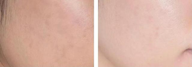 什么是化妆水，什么牌子的化妆水好用（只有搞清楚这几条）