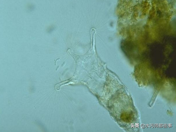 微生物镜检标准是多少，污水处理厂微生物镜检流程与污泥活性分析总结