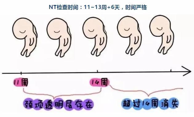 产检nt值多少正常，怀孕nt值多少正常（说明胎儿就是“唐氏儿”吗）