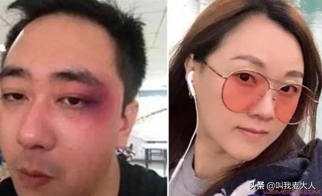著名主持人被前妻家暴，扇500耳光，拿烟头烫脸，打进医院8次