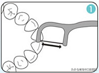 正确使用牙线棒步骤图，现在拔牙多少钱一颗（牙线的正确使用方法，你会吗）