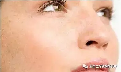 女人吃阿胶糕有什么好处，女人吃阿胶糕的好处（难怪医生建议女人吃阿胶糕）