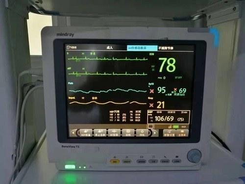 icu病房是什么意思，nicu和picu病房是什么意思（这些仪器都能救命）