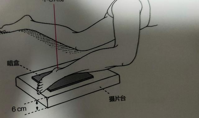 脚踝是哪个部位图解，脚踝是哪个部位图解视频（学习《X线读片指南》骨、关节系统——踝关节）