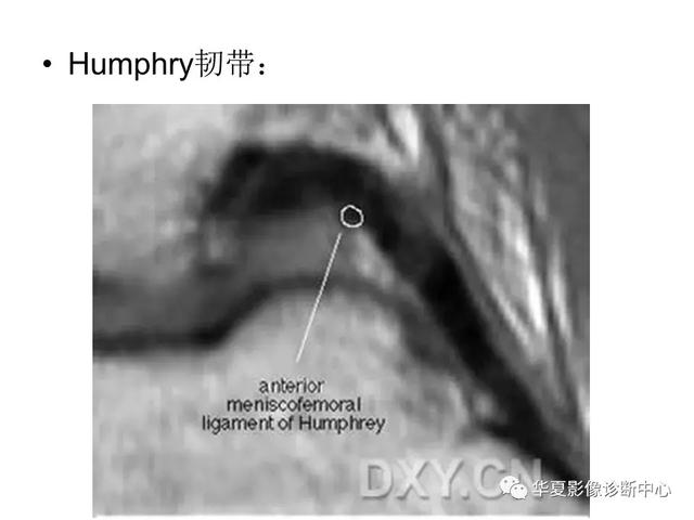 膝关节解剖结构图，膝盖解剖图示意图（膝关节MRI之正常解剖综述）