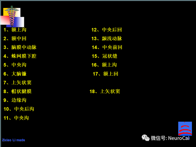 大脑结构图及功能图，人类大脑十大三维解剖图（脑局部解剖与功能图谱）