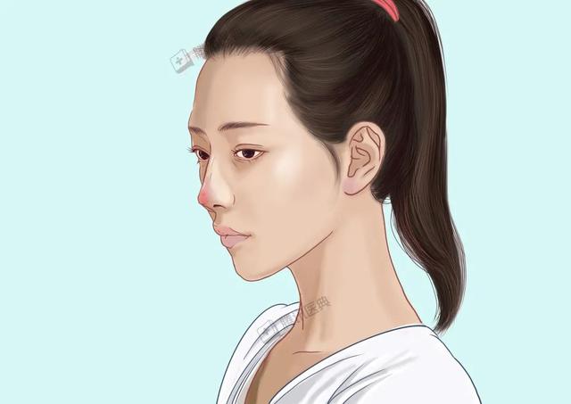 关于隆鼻的五个小常识，千万要注意避免这5个坑