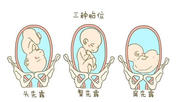 孕27周胎心位置图片图片