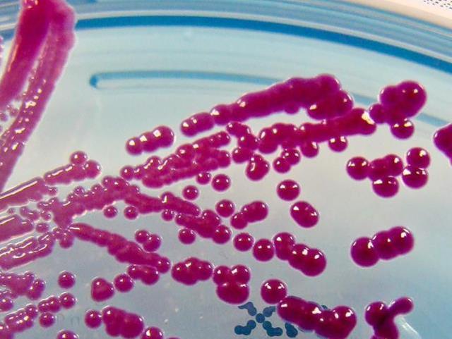 粘质沙雷菌是什么，粘质沙雷氏菌（北美观察丨打开美国历史上的人体试验）