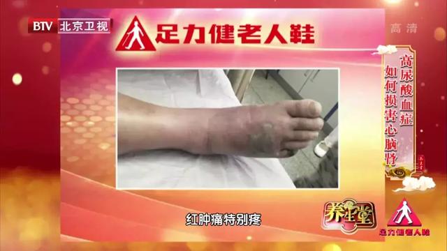 八种有效降尿酸食物，降尿酸8种食物（这些降尿酸的食物要常吃）