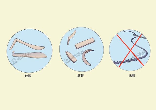 关于隆鼻的五个小常识，千万要注意避免这5个坑