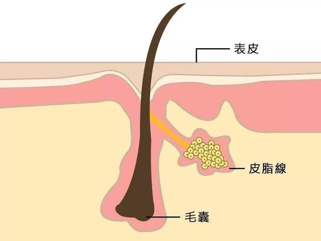 脸上的坑坑洼洼能弄平吗，脸上的坑坑洼洼能弄平的吗（一个方法拯救月球脸）