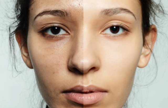 皮肤美白小窍门，皮肤美白小窍门是什么（改善肤色暗沉的4个小技巧）