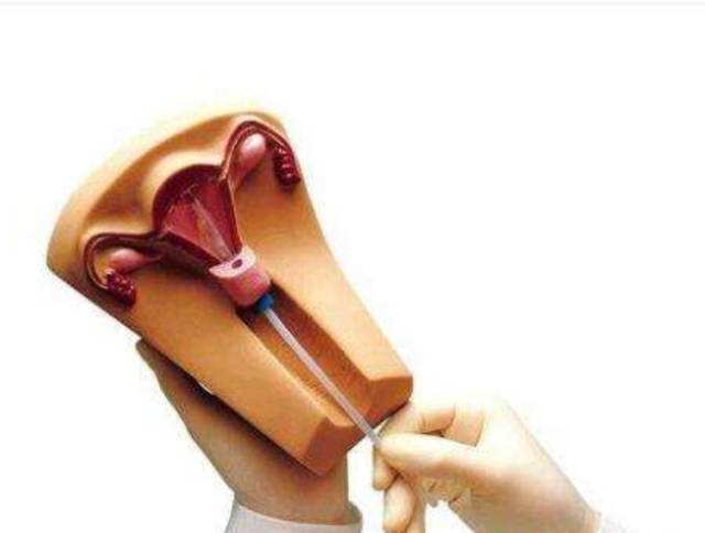 女人上环痛不痛，上环痛不痛对身体有没有什么影响（什么时候需要取环）