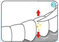 正确使用牙线棒步骤图，现在拔牙多少钱一颗（牙线的正确使用方法，你会吗）