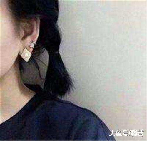 脸上长毛怎么办，用了烟酰胺脸上长毛怎么办（女孩身患“怪病”脸上长毛）