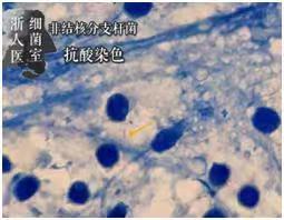 溶脂针瘦腿有什么危害，溶脂针瘦腿有什么危害吗（28岁女子打“瘦腿针”后险遭截肢）