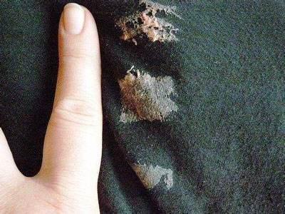 黑色墨水染在衣服上怎样去除，黑墨水弄到衣服上怎么洗掉（衣服粘上了泡泡糖、衣服滴上了蓝墨水）