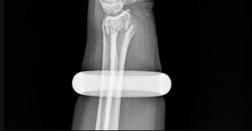 戴玉手镯对女性有什么好处和坏处，戴玉镯对女人有什么好处（因手上“玉镯”多受苦）