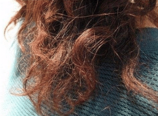 欧莱雅护发精油可以天天用吗 欧莱雅护发精油的好处是什么，欧莱雅护发精油可以天天用吗（冬日也能丝般顺滑）