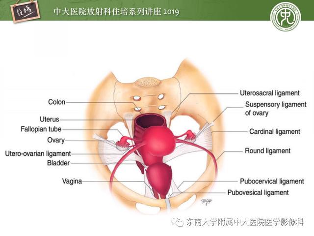 子宫颈影像解剖，子宫详细解剖及磁共振信号分析