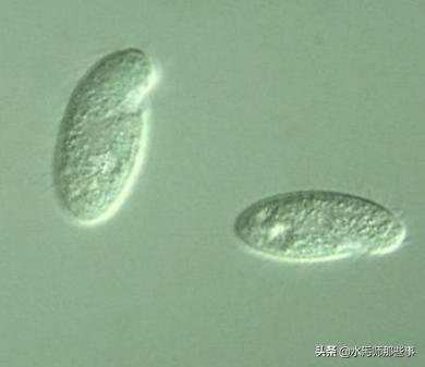 微生物镜检标准是多少，污水处理厂微生物镜检流程与污泥活性分析总结
