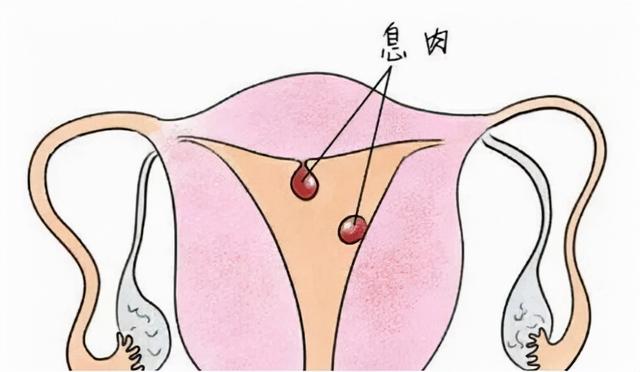 既治好了病，又不耽误工作，真好