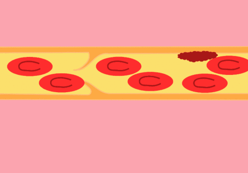 石斛粉的功效与作用，石斛粉功效与作用（降压三宝、降脂三宝、降糖三宝）