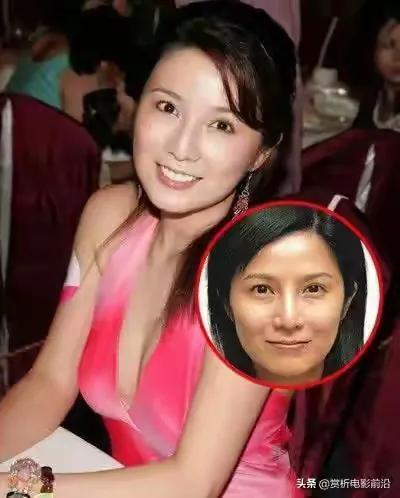 公开承认整形+隆胸的十位女明星，大胆对比照片，你是否有感觉呢