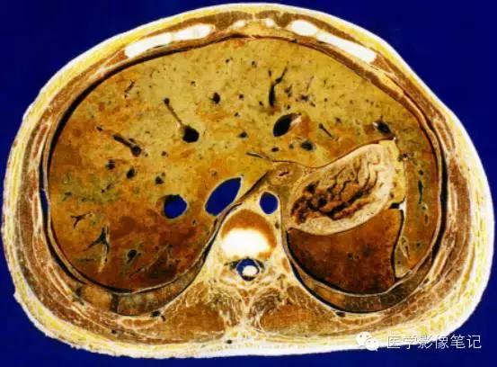 吃赖尿虾的好处，孕妇可以吃濑尿虾吗中期（这8种肝脏变异）