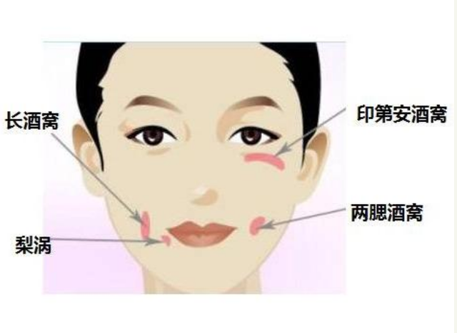 酒窝是怎么形成的，脸上的酒窝是怎么形成的（”科学解释酒窝形成）