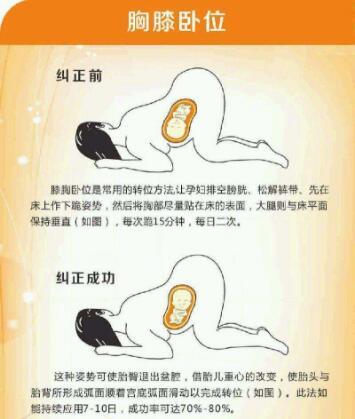 胎位roa是什么意思，胎位roa是什么胎位图片（B超单的胎位关系到能否顺产）