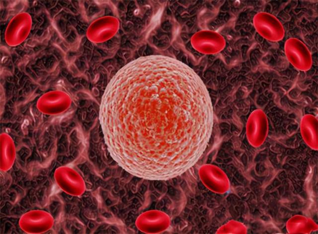 胆红素偏高的原因及危害，胆红素偏高的危害是什么（什么原因会引起胆红素的升高）