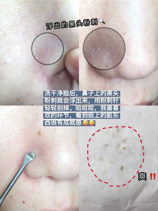 清洁面膜敷多久，清洁面膜多久做一次比较好（清洁面膜怎么敷才正确）