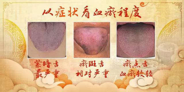 血液和血浆的区别，血浆跟血液有什么不同（可能都是吃出来的）