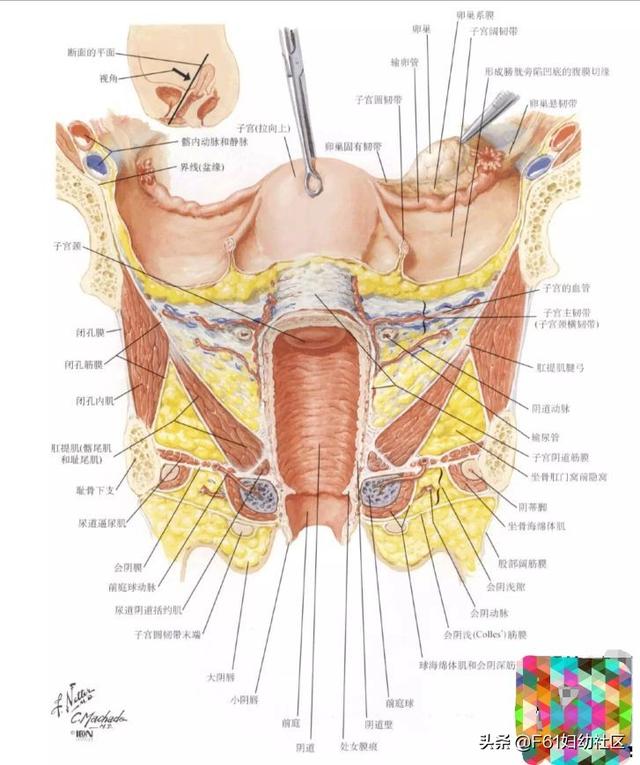 子宫是什么样子的有图片吗，子宫是什么样子的（子宫及附件解剖图及详细讲解）