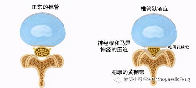 后纵韧带解剖图，颈椎的韧带有哪些