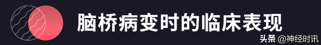 关于脑桥介绍，脑桥包括什么（脑桥的血液供应及病变时的临床表现）