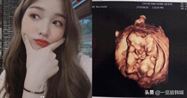 韩国23岁女爱豆未婚生子1年后再怀双胞胎丈夫崔珉焕把她宠上天