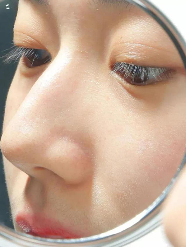 青春痘痘印怎么去除，青春痘痘印怎么去除有效（居然把我的痘痘痘印黑头都去掉了）