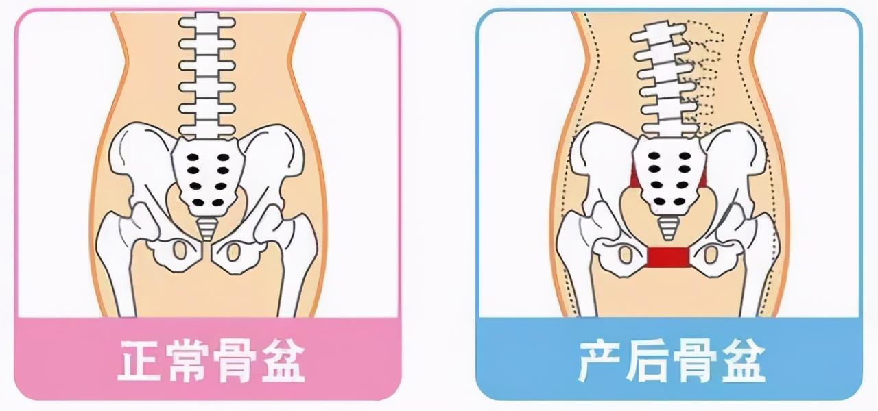 打过无痛后脊椎中间一处疼，注射无痛分娩针后脊椎疼痛是什么情况（打无痛分娩产后会腰痛吗）