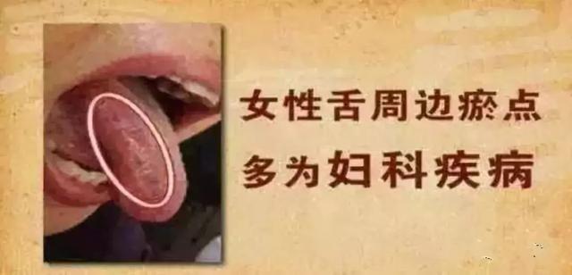 健康的舌头图片，如何判断自己的舌头健康状况（五脏在舌头均有反射区）