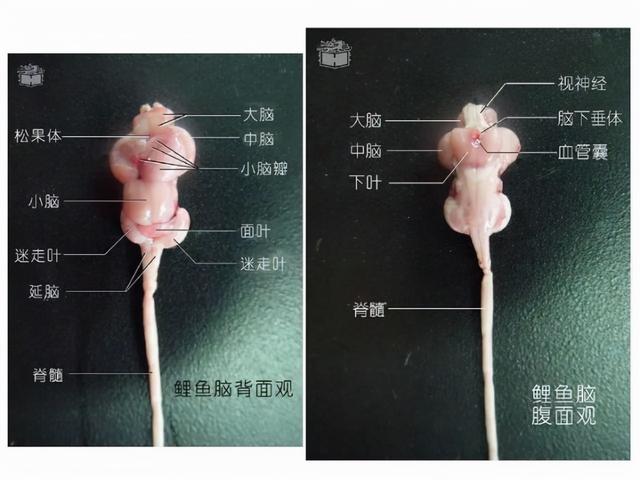 宇宙进化系统，为什么只有人类进化出高度发达的大脑