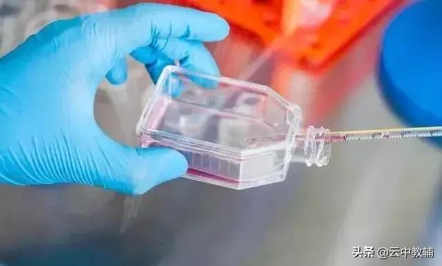 大肠杆菌菌落特征，大肠杆菌培养（一位高中生物老师分享对生物的理解）