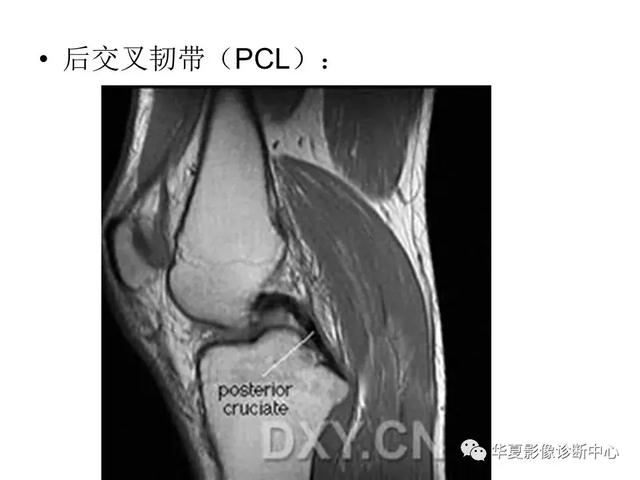 膝关节解剖结构图，膝盖解剖图示意图（膝关节MRI之正常解剖综述）