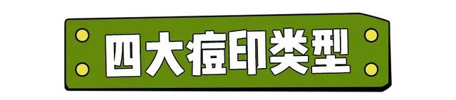 什么药膏可以祛痘,痘痘可以用什么药膏(到药店买这6种小药膏。平价有效) 什么药膏可以祛痘,痘痘可以用什么药膏(到药店买这6种小药膏。平价有效)
